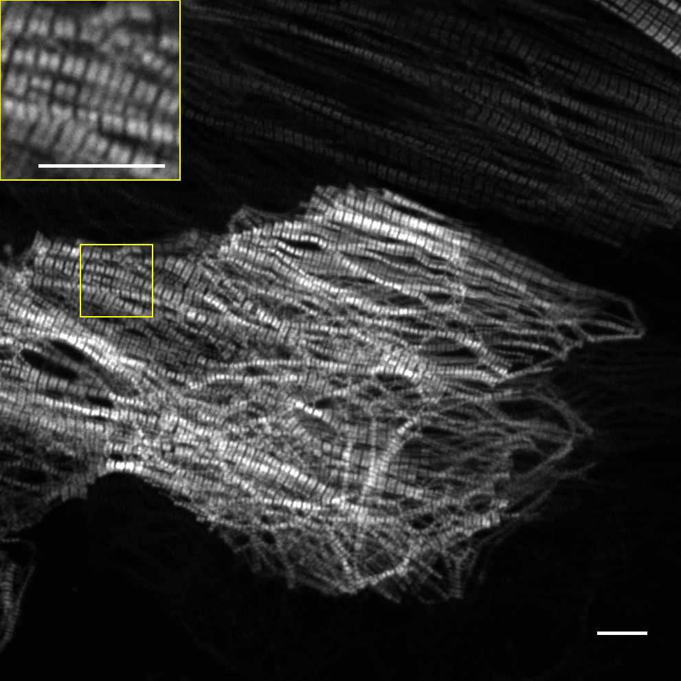 [object Object] thumbnail