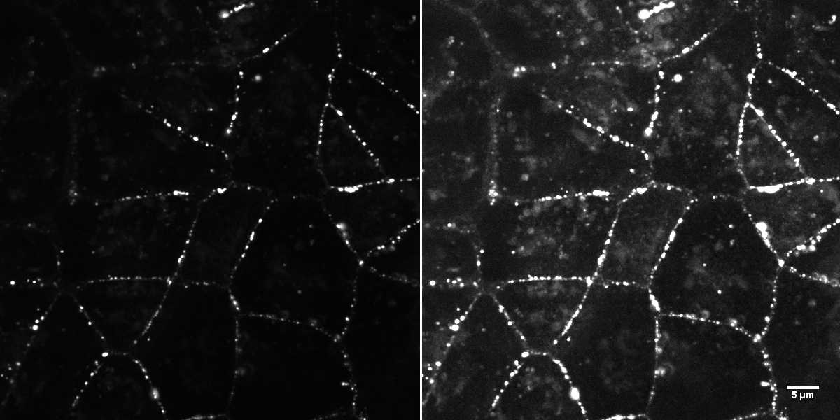 [object Object] thumbnail