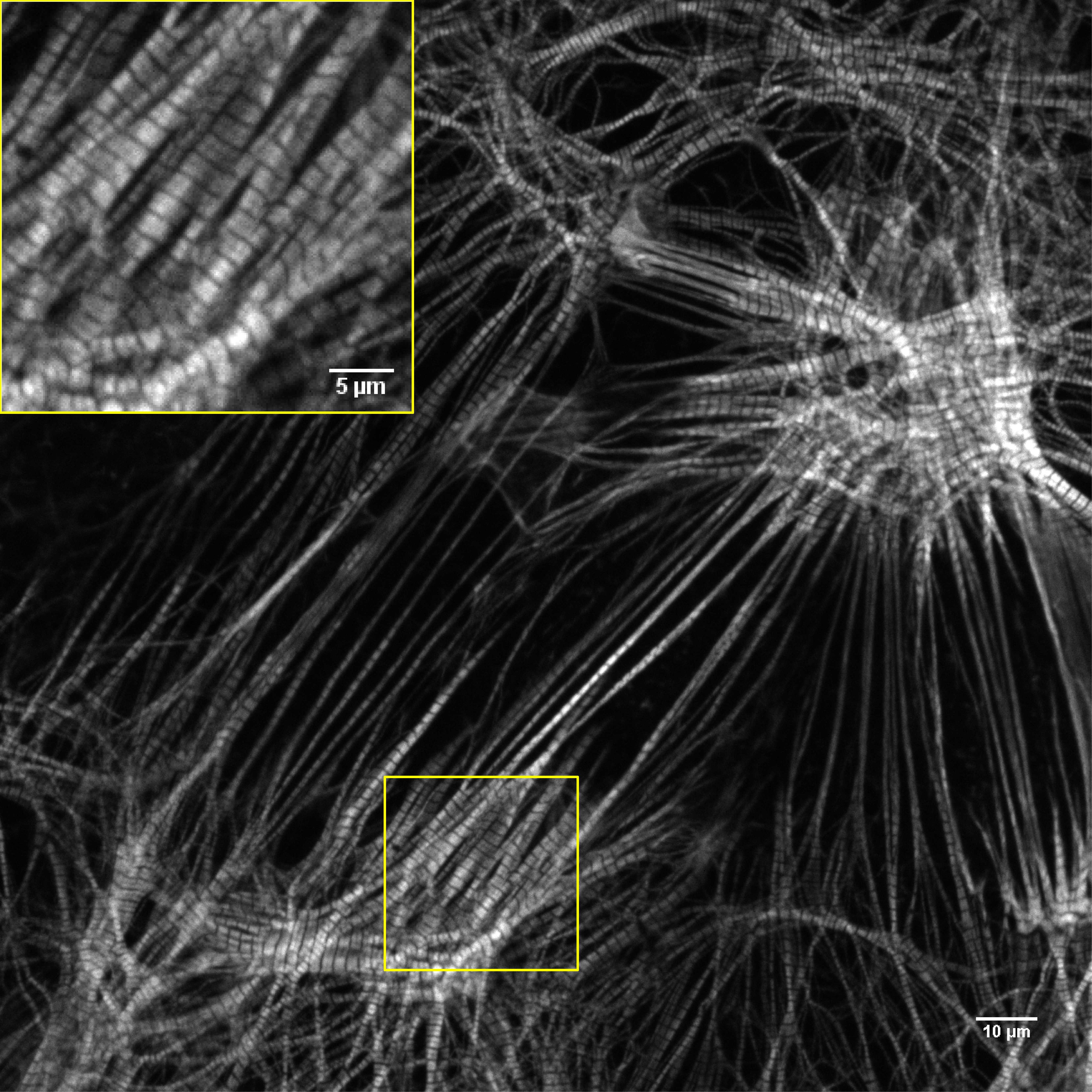 [object Object] thumbnail