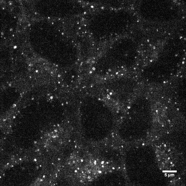 [object Object] thumbnail