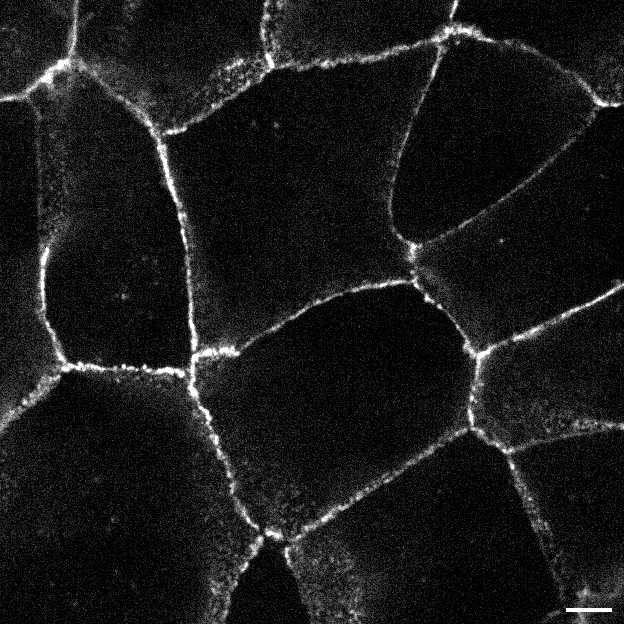 [object Object] thumbnail