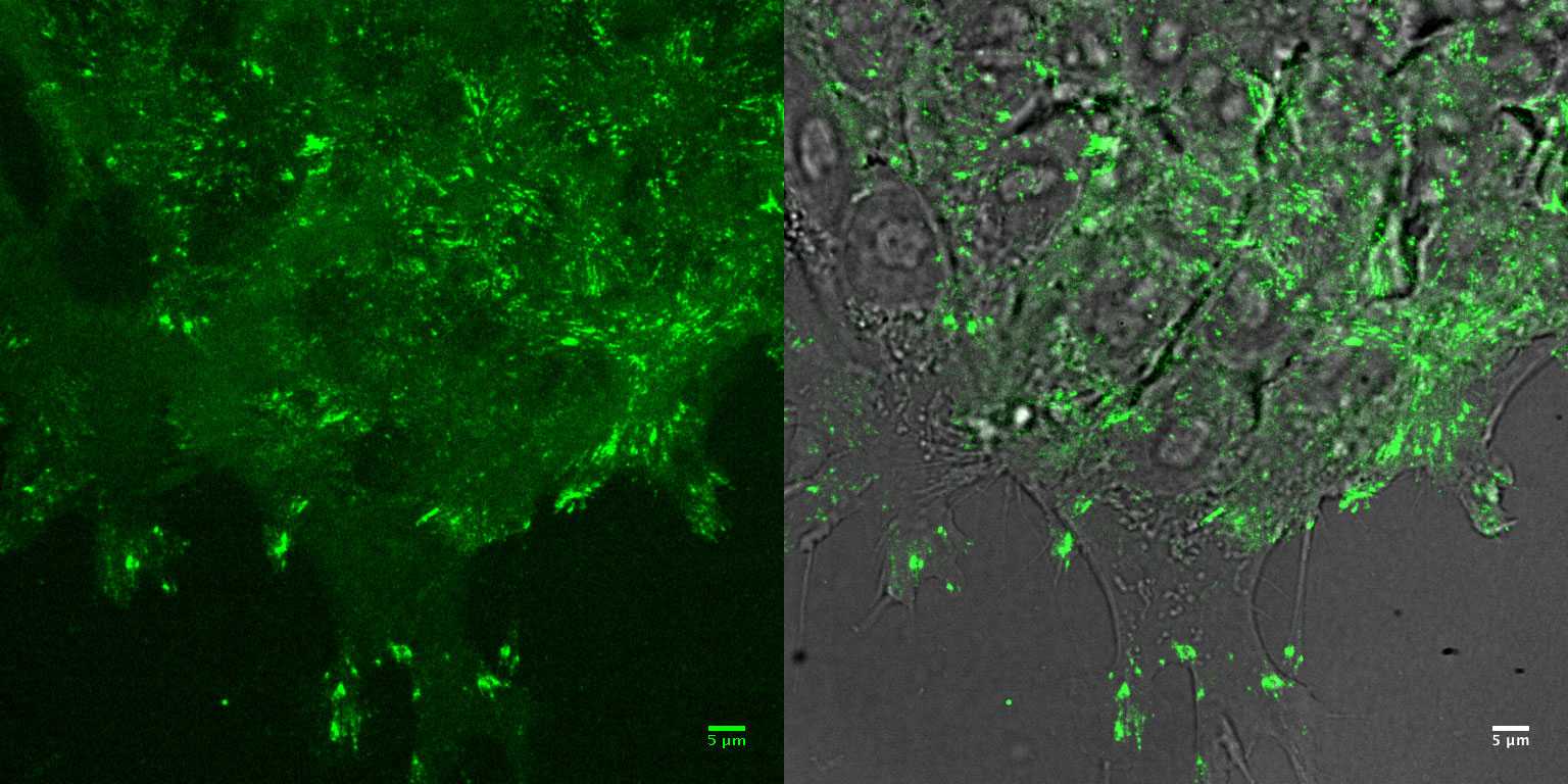 [object Object] thumbnail