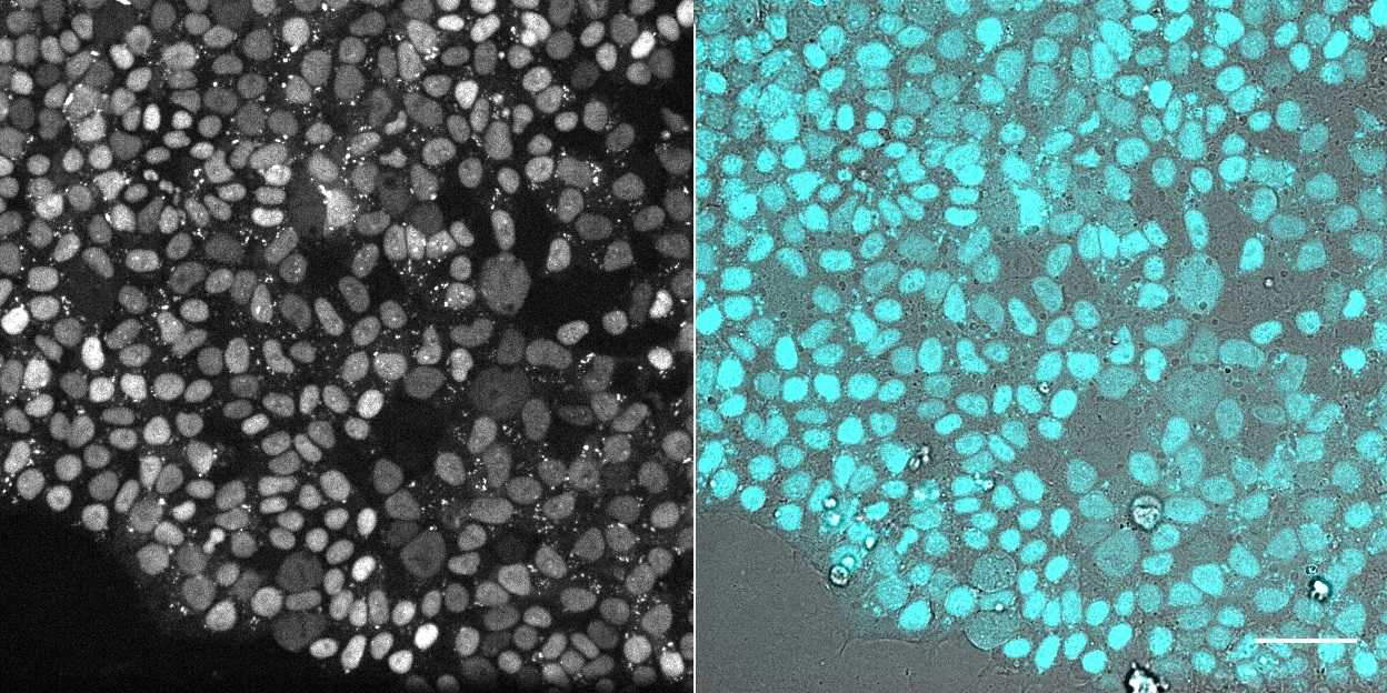 [object Object] thumbnail