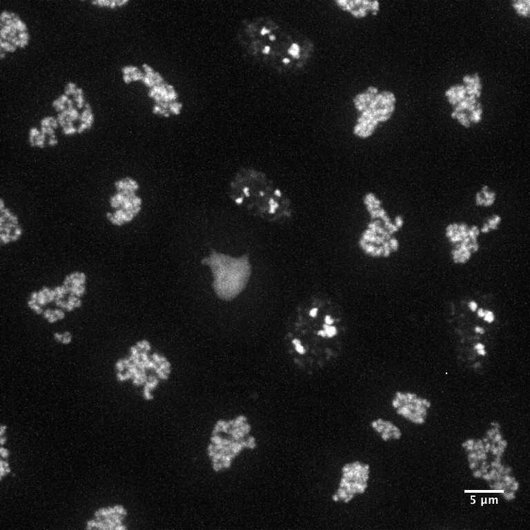 [object Object] thumbnail